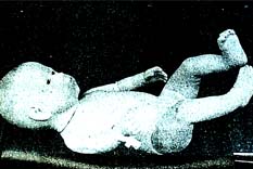 Doktora bak doktora!